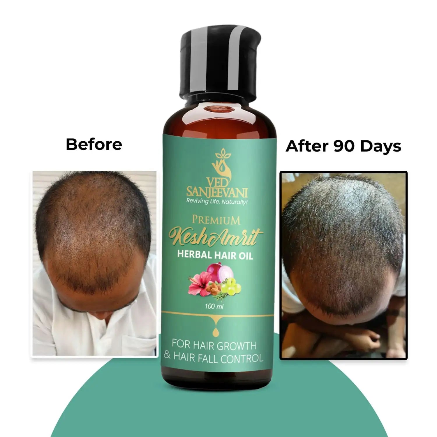 Kesh Amrit Herbal Hair Oil – Nectar for Hair - Ved Sanjeevani (Image 8)