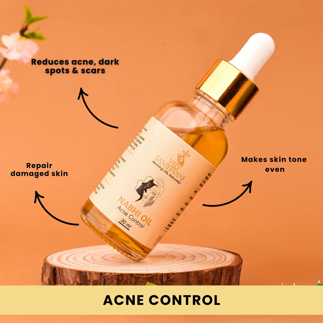 Acne Control Nabhi Oil – Ayurvedic belly button oil for clear skin, acne reduction, and balanced complexion