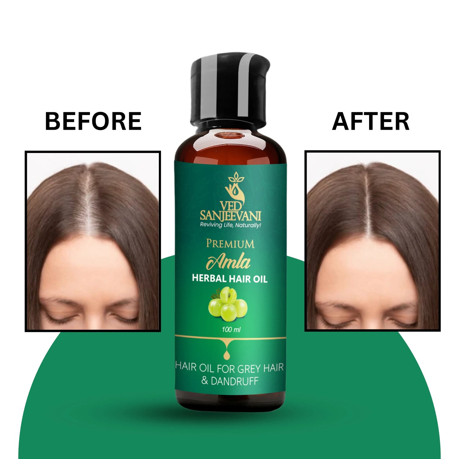 Amla Herbal Hair Oil – Ayurvedic hair oil provides antioxidant nourishment through Amla and Vitamin C.