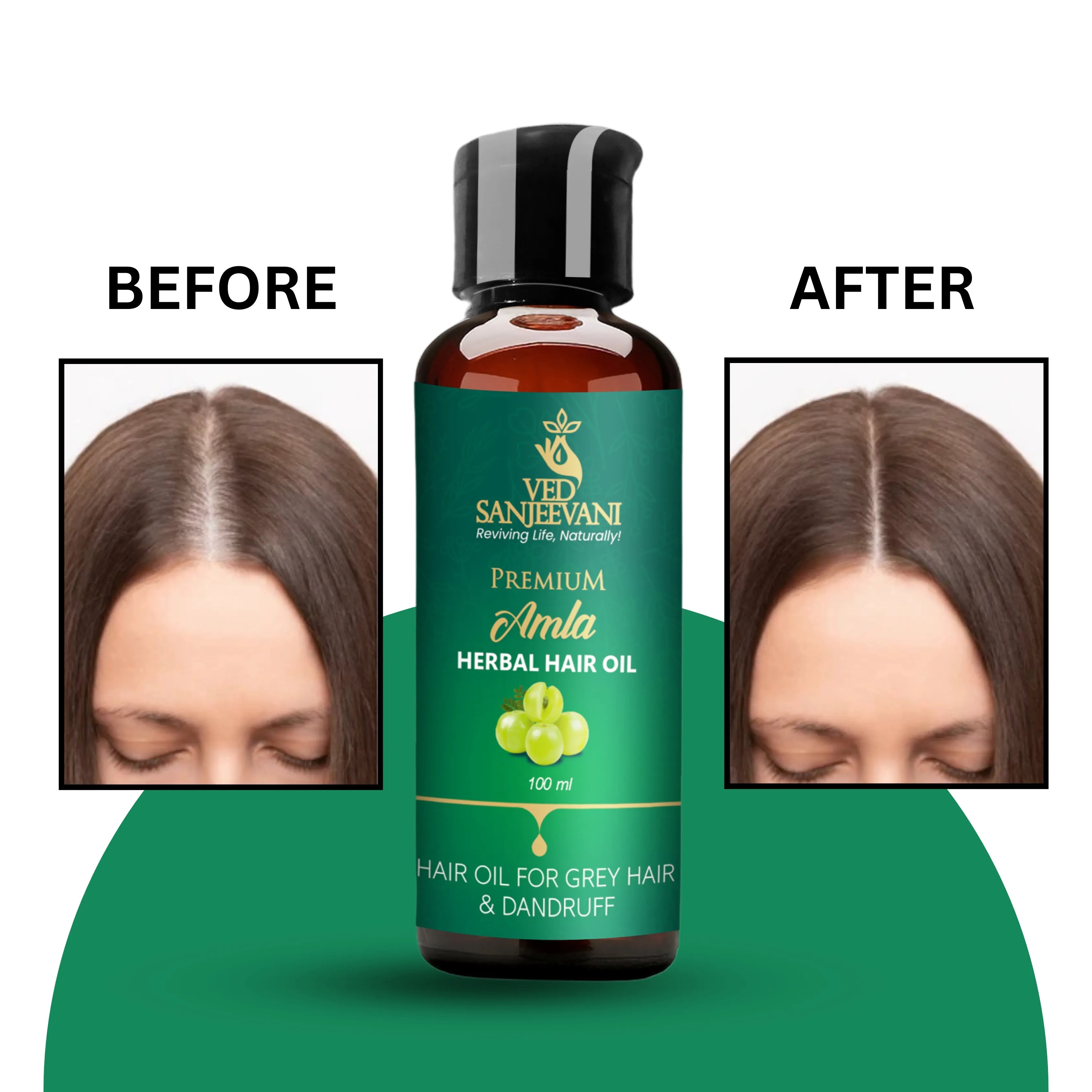 Amla Herbal Hair Oil – Ayurvedic hair oil provides antioxidant nourishment through Amla and Vitamin C.