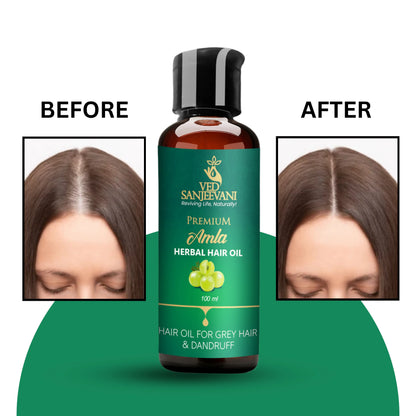 Amla Herbal Hair Oil – Ayurvedic hair oil provides antioxidant nourishment through Amla and Vitamin C.