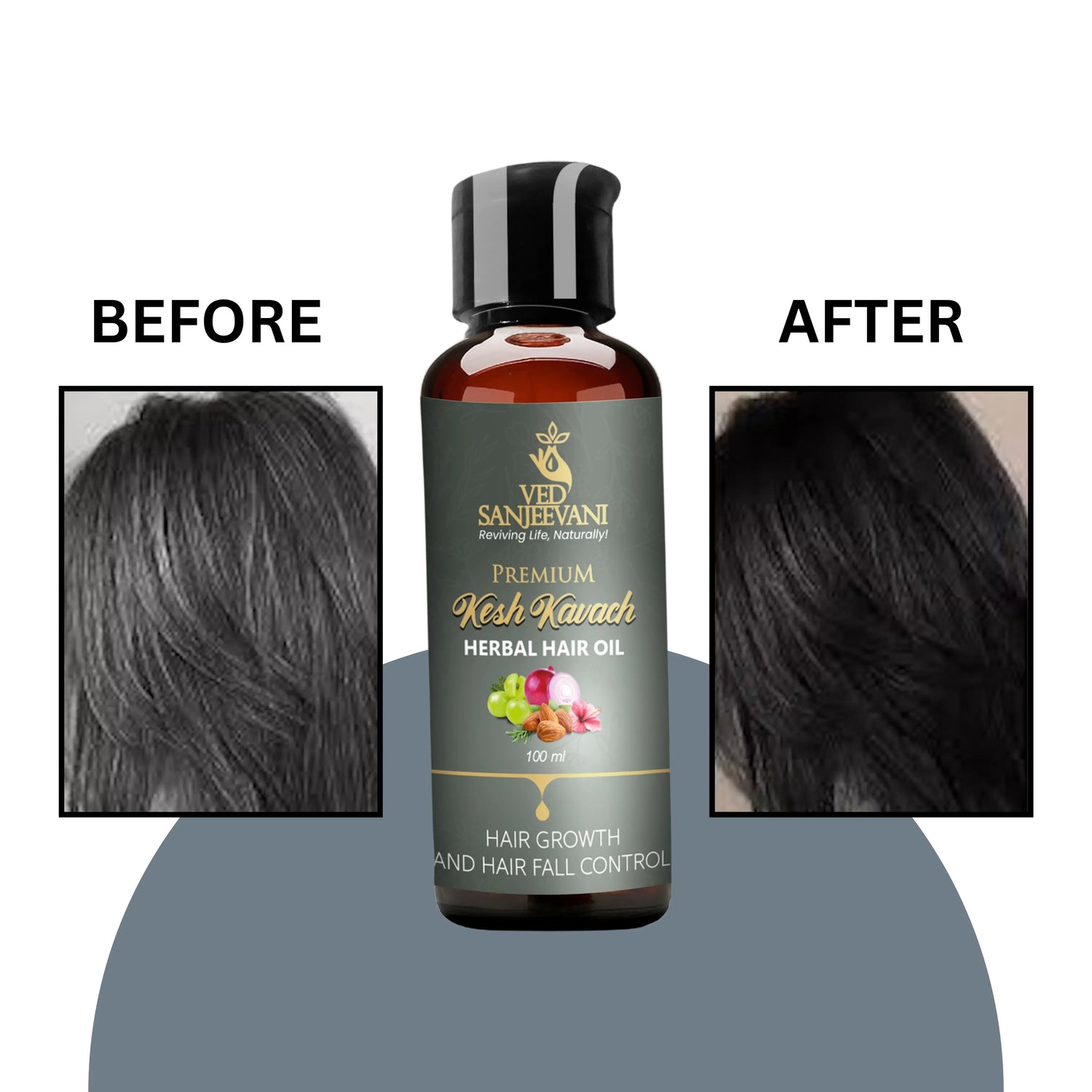 Kesh Kavach Herbal Hair Oil benefits for moisture retention and preventing hair dryness