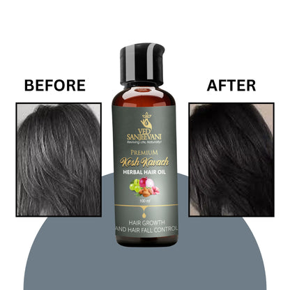 Kesh Kavach Herbal Hair Oil benefits for moisture retention and preventing hair dryness