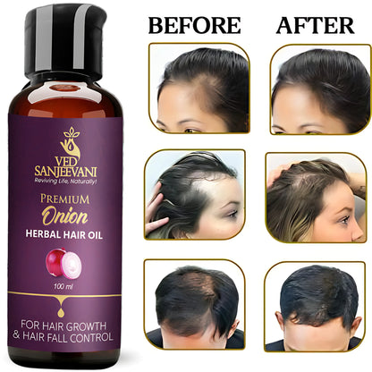 Onion Herbal Hair Oil – Ayurvedic oil for hair growth, reduced hair fall, and scalp nourishment