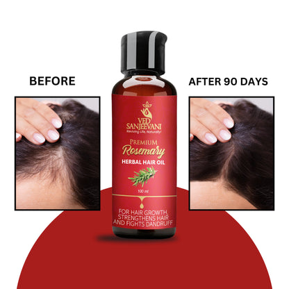 Rosemary Herbal Hair Oil – Nourishing Ayurvedic oil for hair growth, scalp health, and stronger strands